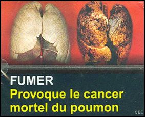 Djibouti 2009 Health Effects lung - diseased organ, lung cancer, gross - French